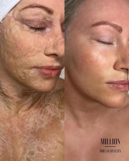 Million dollar miracle mask